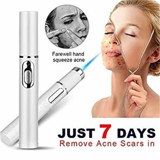 Blue Light Therapy Acne Pen – Scar & Wrinkle Removal Beauty Device